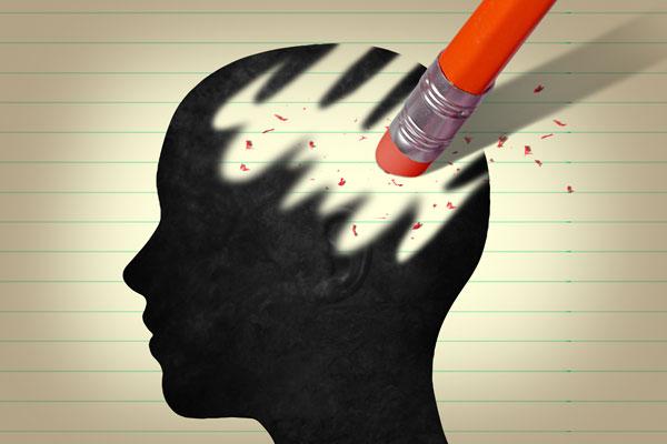 Degeneración Corticobasal