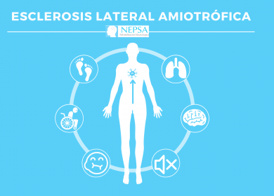 Día de la Esclerosis lateral Amiotrófica